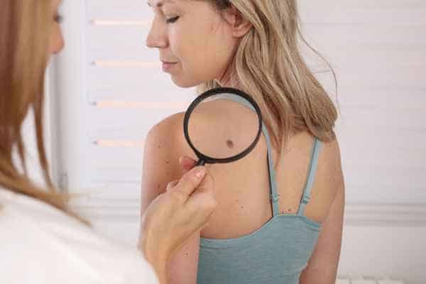 What Are Traditional Skin Lesion Removal Methods Andover?