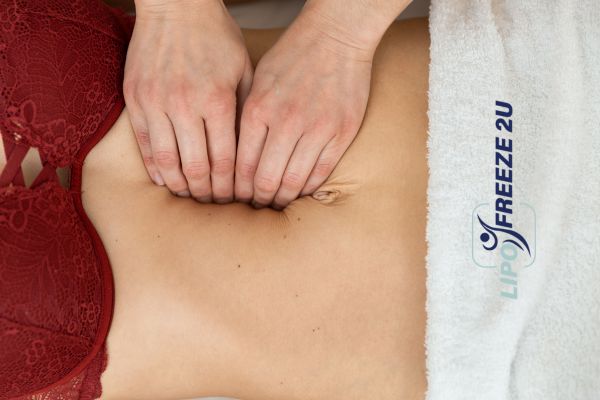diastasis recti treatment Andover
