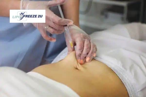 Fat Dissolving Injections Andover & Weight loss medication