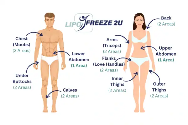 Areas you can have fat freezing treatment Andover