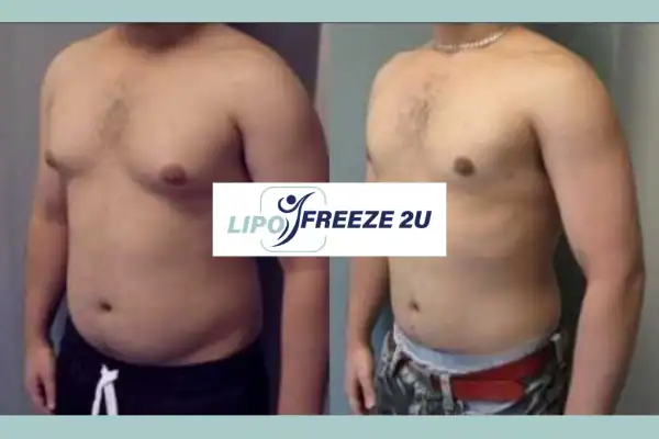 How Long Does It Take to See Results Andover?
