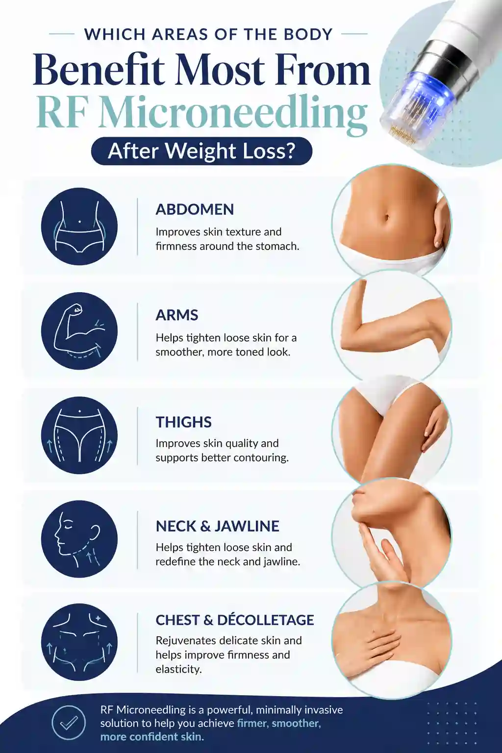 Which Areas of the Body Benefit Most From RF Microneedling After Weight Loss Andover